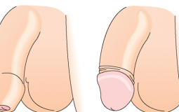 hep-bao-quy-dau-nguyen-nhan-do-dau-dau-hieu-va-cach-dieu-tri