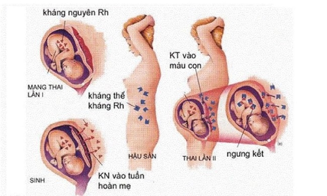 khám thai giá bao nhiêu tiền