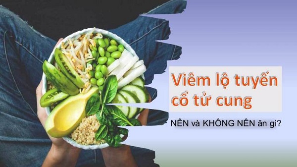 Bị viêm lộ tuyến kiêng gì ăn gì?